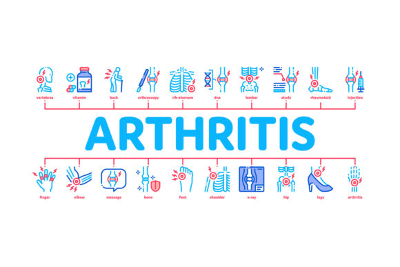 Arthritis Disease Minimal Infographic Design Guide